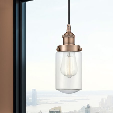 A large image of the Innovations Lighting 616-1PH-10-5 Dover Pendant Alternate Image