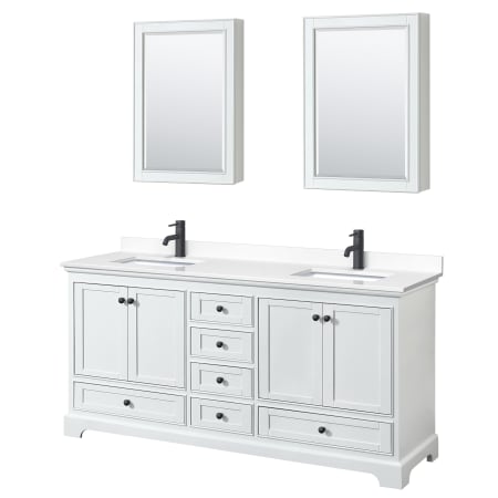 A large image of the Wyndham Collection WCS202072D-VCA-MED White / White Cultured Marble Top / Matte Black Hardware