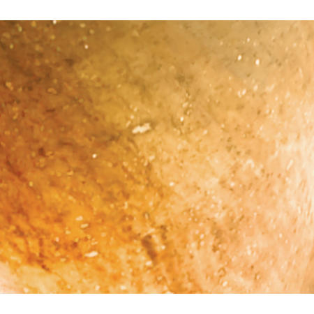 Alternate Image